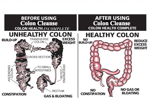 healthy_unhealthy_colon