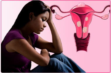 teen girl with heavy periods